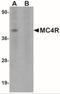 Melanocortin 4 Receptor antibody, NBP2-41103, Novus Biologicals, Western Blot image 