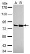DNA Cross-Link Repair 1C antibody, PA5-27112, Invitrogen Antibodies, Western Blot image 