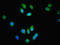 SPG21 Abhydrolase Domain Containing, Maspardin antibody, orb38685, Biorbyt, Immunocytochemistry image 