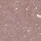 Mtg8 antibody, HPA070951, Atlas Antibodies, Immunohistochemistry paraffin image 