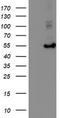 Histidyl-TRNA Synthetase 2, Mitochondrial antibody, TA503834, Origene, Western Blot image 