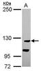 Cation Channel Sperm Associated Auxiliary Subunit Beta antibody, PA5-31585, Invitrogen Antibodies, Western Blot image 
