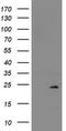 NADH:Ubiquinone Oxidoreductase Subunit B9 antibody, TA502553AM, Origene, Western Blot image 