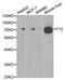 Coagulation Factor XII antibody, A1691, ABclonal Technology, Western Blot image 