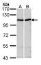 ACTN4 antibody, GTX113115, GeneTex, Western Blot image 