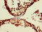Zinc Finger CCCH-Type, RNA Binding Motif And Serine/Arginine Rich 2 antibody, CSB-PA618014LA01HU, Cusabio, Immunohistochemistry paraffin image 