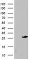 Sperm surface protein Sp17 antibody, CF804294, Origene, Western Blot image 