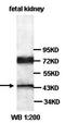 YY1 Transcription Factor antibody, orb77378, Biorbyt, Western Blot image 