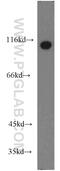 Drebrin 1 antibody, 10260-1-AP, Proteintech Group, Western Blot image 