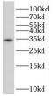 Homeobox protein TGIF2LX antibody, FNab08648, FineTest, Western Blot image 