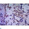 Transducin Beta Like 1 X-Linked Receptor 1 antibody, LS-C813130, Lifespan Biosciences, Immunohistochemistry paraffin image 