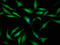 SBDS Ribosome Maturation Factor antibody, LS-C673058, Lifespan Biosciences, Immunofluorescence image 