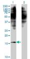 Nuclear nucleic acid-binding protein C1D antibody, H00010438-M10, Novus Biologicals, Western Blot image 