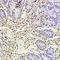 CD177 antigen antibody, orb10302, Biorbyt, Immunohistochemistry paraffin image 