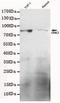 G Protein-Coupled Receptor Kinase 2 antibody, TA346873, Origene, Western Blot image 
