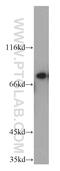 Peroxisomal Biogenesis Factor 5 antibody, 12545-1-AP, Proteintech Group, Western Blot image 