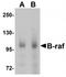 Serine/threonine-protein kinase B-raf antibody, TA319622, Origene, Western Blot image 