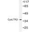 Cysteinyl Leukotriene Receptor 2 antibody, LS-C177097, Lifespan Biosciences, Western Blot image 