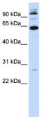 MAX Network Transcriptional Repressor antibody, TA345285, Origene, Western Blot image 