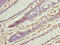 IlvB Acetolactate Synthase Like antibody, CSB-PA011687LA01HU, Cusabio, Immunohistochemistry paraffin image 