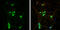 RAB7A, Member RAS Oncogene Family antibody, GTX132548, GeneTex, Immunocytochemistry image 