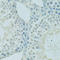 DFS70 antibody, A14852, ABclonal Technology, Western Blot image 