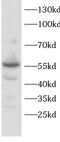 Prostacyclin synthase antibody, FNab10312, FineTest, Western Blot image 