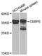 CCAAT Enhancer Binding Protein Epsilon antibody, A8047, ABclonal Technology, Western Blot image 