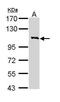 Cytokine receptor common subunit beta antibody, PA5-29794, Invitrogen Antibodies, Western Blot image 