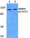 CtIP antibody, PA5-37337, Invitrogen Antibodies, Western Blot image 