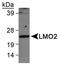LIM Domain Only 2 antibody, TA336557, Origene, Western Blot image 