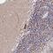 Zinc Finger Protein 573 antibody, NBP1-92631, Novus Biologicals, Immunohistochemistry frozen image 