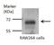 Glutaminase antibody, GTX114982, GeneTex, Western Blot image 