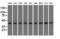 Acetyl-CoA Acetyltransferase 2 antibody, GTX84968, GeneTex, Western Blot image 