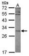 SNF8 Subunit Of ESCRT-II antibody, GTX119948, GeneTex, Western Blot image 