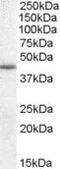Cellular Communication Network Factor 4 antibody, PA5-18832, Invitrogen Antibodies, Western Blot image 