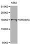 Drosha Ribonuclease III antibody, MBS9128223, MyBioSource, Western Blot image 