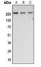 Fibronectin 1 antibody, MBS8201161, MyBioSource, Western Blot image 