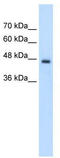 Phosphate Cytidylyltransferase 2, Ethanolamine antibody, TA332113, Origene, Western Blot image 
