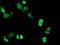 Replication Termination Factor 2 antibody, MA5-25405, Invitrogen Antibodies, Immunocytochemistry image 