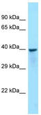 HEAT Repeat Containing 9 antibody, TA343275, Origene, Western Blot image 
