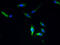 Protein tweety homolog 1 antibody, A61606-100, Epigentek, Immunofluorescence image 