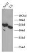 SUFU Negative Regulator Of Hedgehog Signaling antibody, FNab10794, FineTest, Western Blot image 