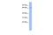 Ribonucleoprotein, PTB Binding 2 antibody, GTX47283, GeneTex, Western Blot image 