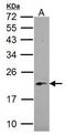 NADH:Ubiquinone Oxidoreductase Subunit B5 antibody, GTX111880, GeneTex, Western Blot image 