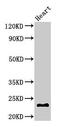 Crystallin Beta A4 antibody, CSB-PA006011LA01HU, Cusabio, Western Blot image 