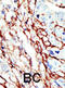 EPH Receptor A7 antibody, abx033524, Abbexa, Immunohistochemistry paraffin image 