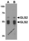 Glutaminase 2 antibody, 6217, ProSci, Western Blot image 