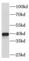 Retinol Dehydrogenase 10 antibody, FNab07216, FineTest, Western Blot image 