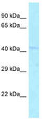 Dipeptidase 2 antibody, TA343219, Origene, Western Blot image 